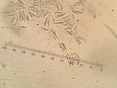 Nectriopsis rubefaciens