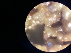 Crepidula onyx