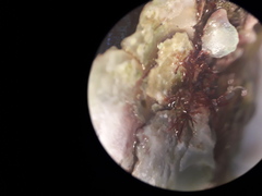 Crepipatella lingulata