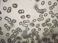 Tricholomopsis scabra