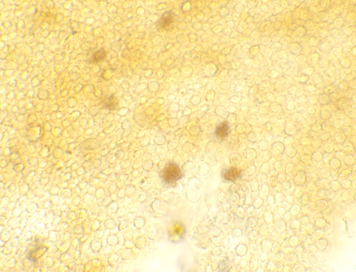 Psathyrella (Photo 11 of 12)