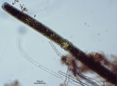 Pleurotaenium trabecula