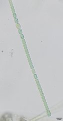 Anabaena inaequalis