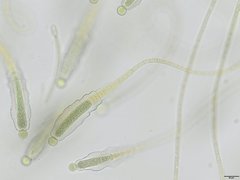 Gloeotrichia