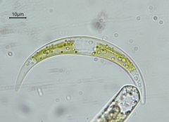 Closterium parvulum