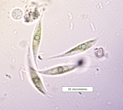 Keratococcus