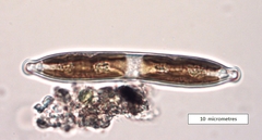 Hantzschia amphioxys