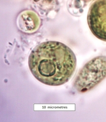 Chlorococcaceae