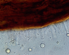 Gloiocephala phormiorum