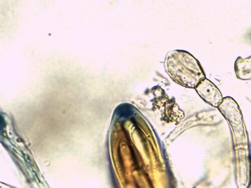 Geoglossum (Photo 4 of 4)