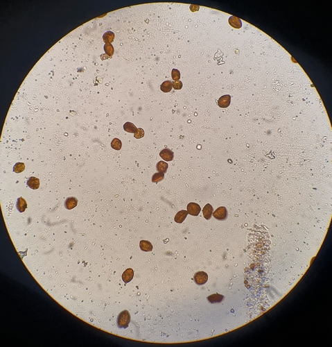 Image of Ptychostomum compactum by no rights reserved