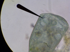 Stentor coeruleus