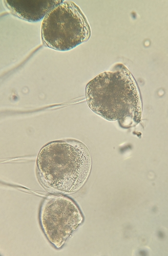 Vorticella