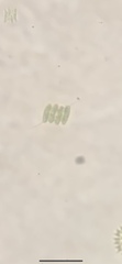 Desmodesmus communis