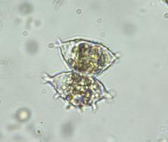 Staurastrum avicula
