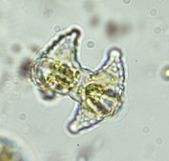 Staurastrum cyrtocerum