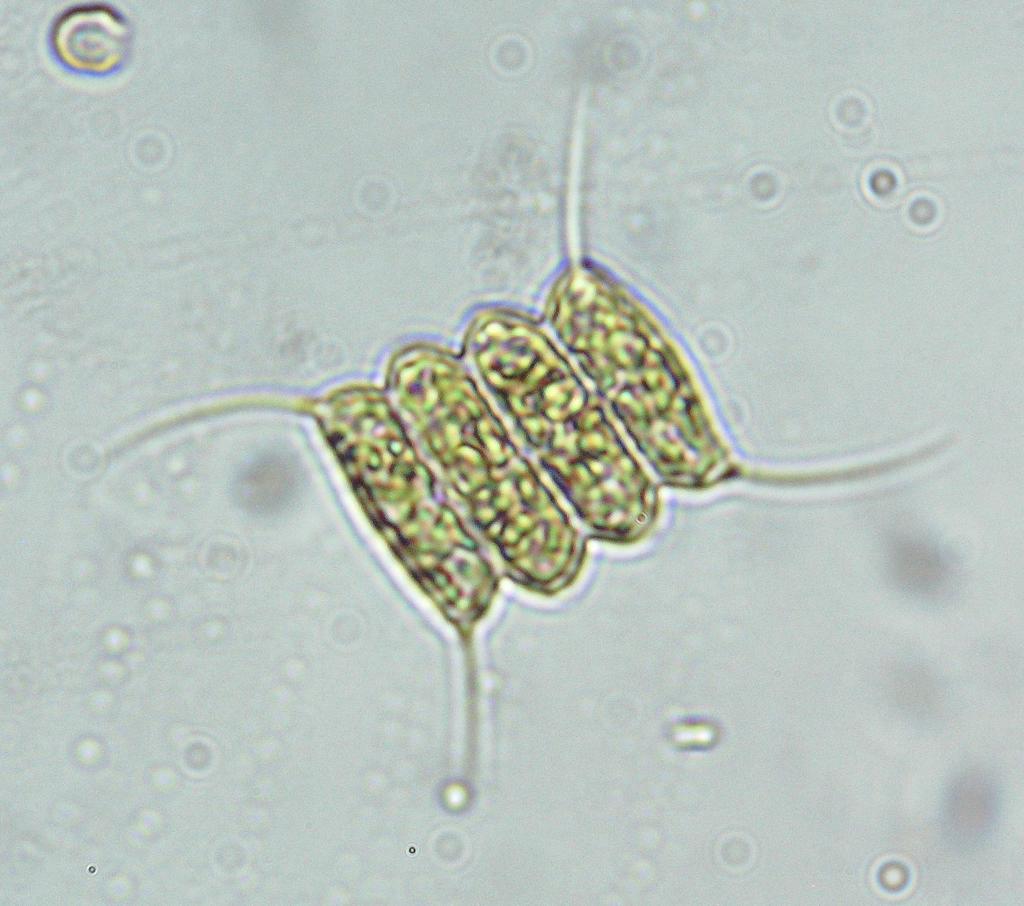 Scenedesmus quadricauda (Scenedesmus quadricauda)