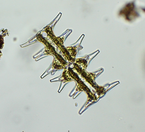 Micrasterias muricata