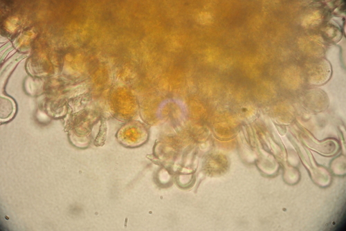 Puccinia brachypodii