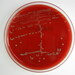 Fusobacterium - Photo (c) mostly*harmless, some rights reserved (CC BY-NC)