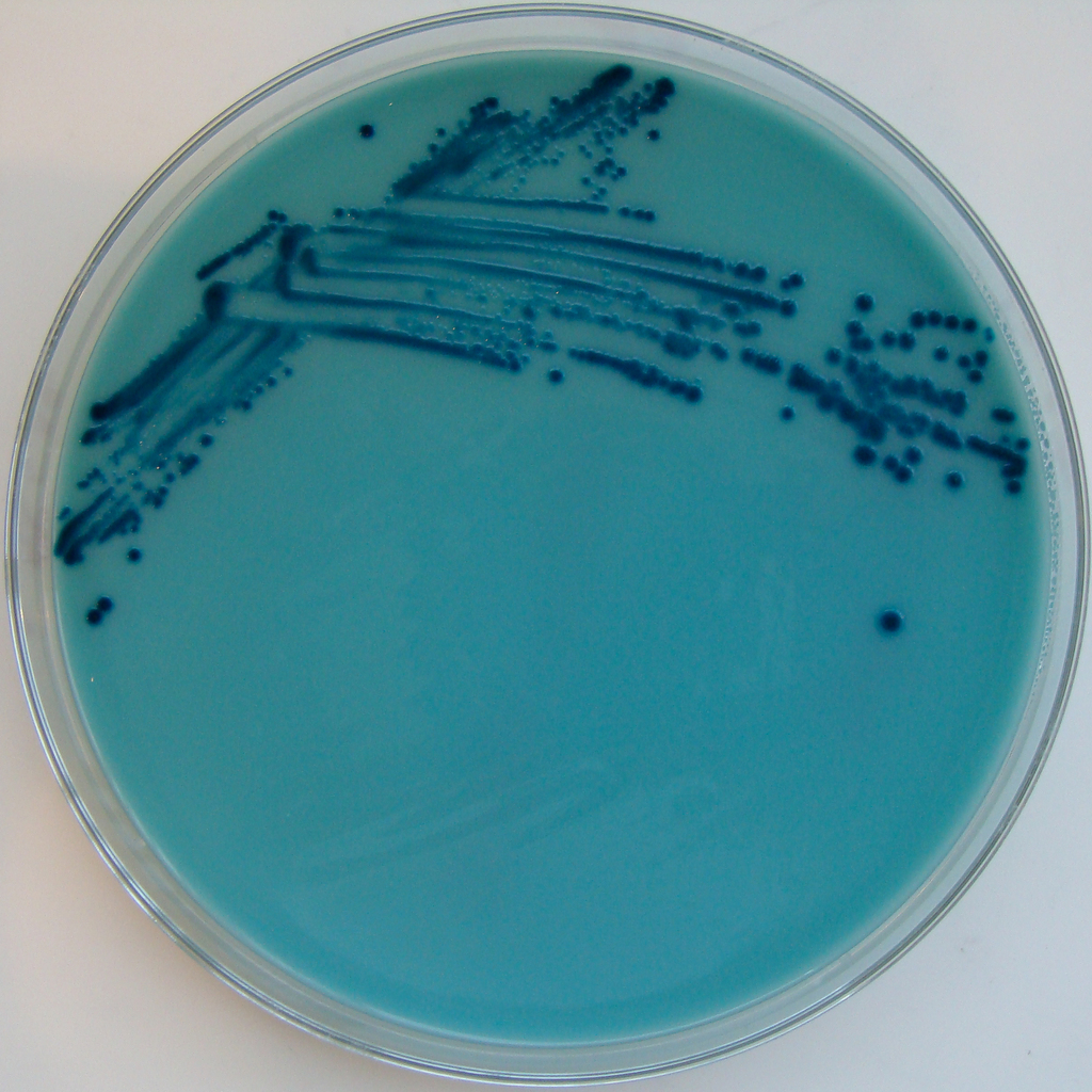 Enterobacter