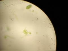 Scenedesmus