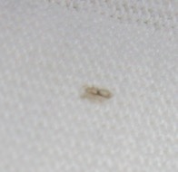 Pediculus humanus capitis