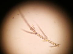 Chaetophora