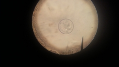 Coscinodiscophycidae