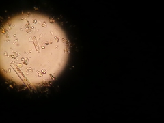 Hantzschia amphioxys