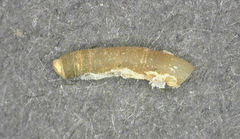 Caecum dextroversum