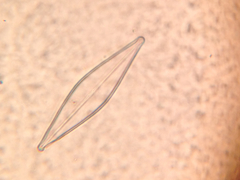 Frustulia rhomboides