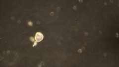 Vorticella campanula