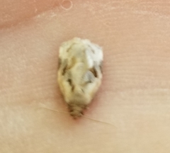 Archips grisea