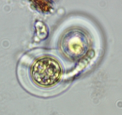 Asterococcus superbus