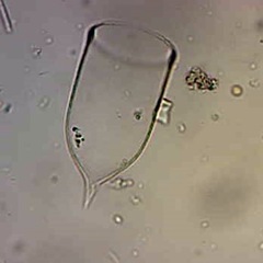 Favella