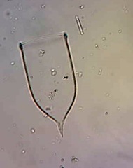 Favella