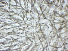 Chaetophora