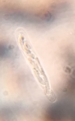 Graphostroma platystomum