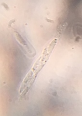 Graphostroma platystomum