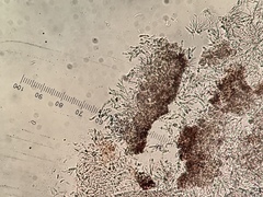 Epicladonia stenospora