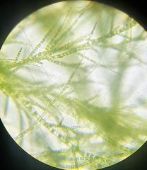 Stigeoclonium