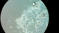 Ossicaulis