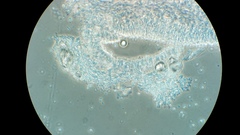 Ossicaulis