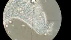 Ossicaulis