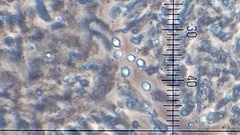 Ossicaulis