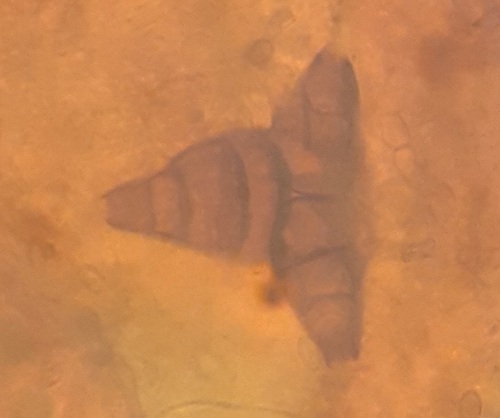 Asterosporium asterospermum observed 2024-04-29