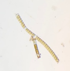 Fragilaria