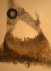 Puccinia investita