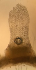 Puccinia investita
